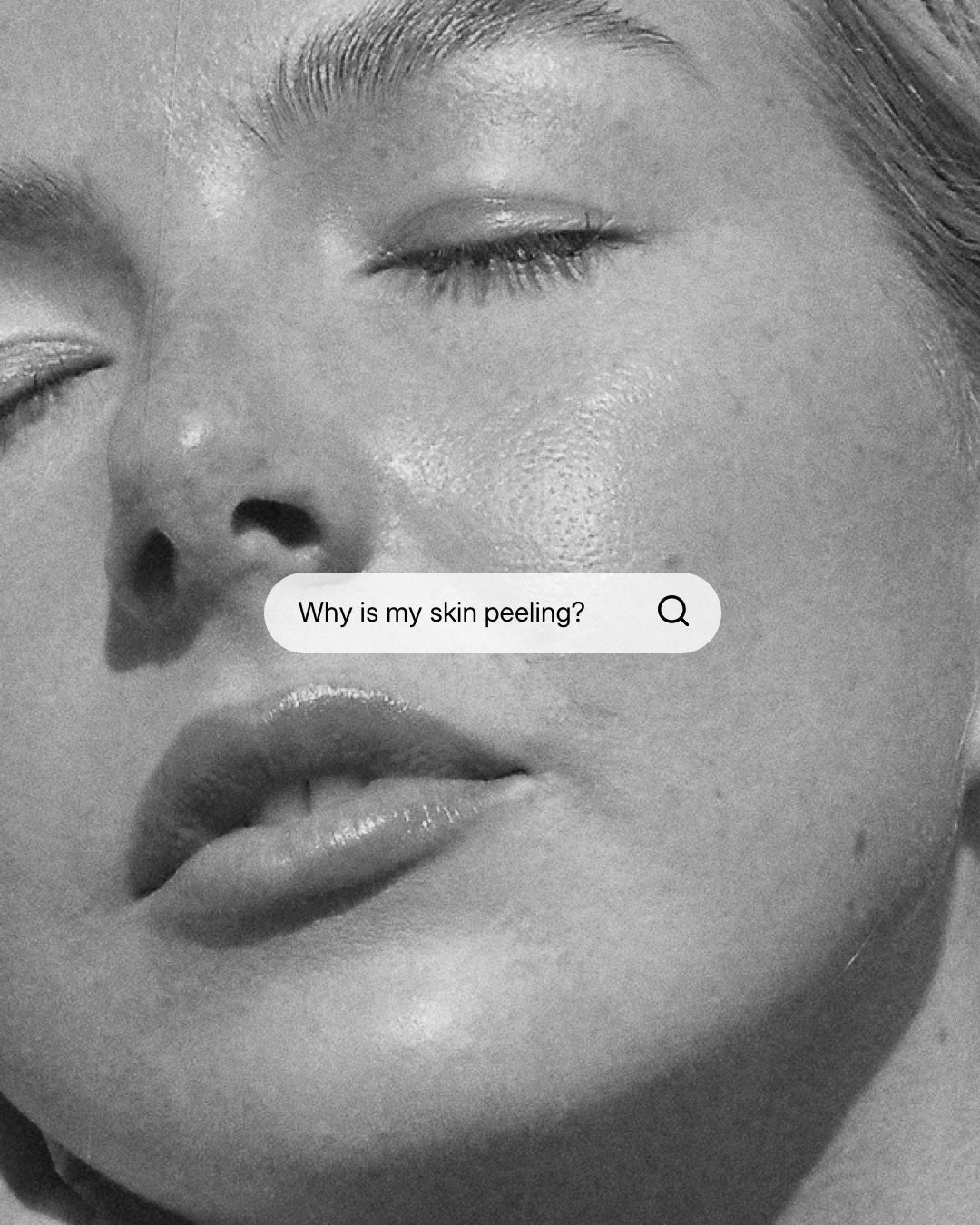 Why is my skin peeling? Your guide to adjusting to Vitamin A
