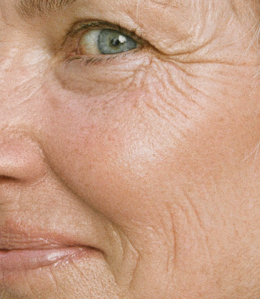 Why your skin changes at menopause, and what actually helps