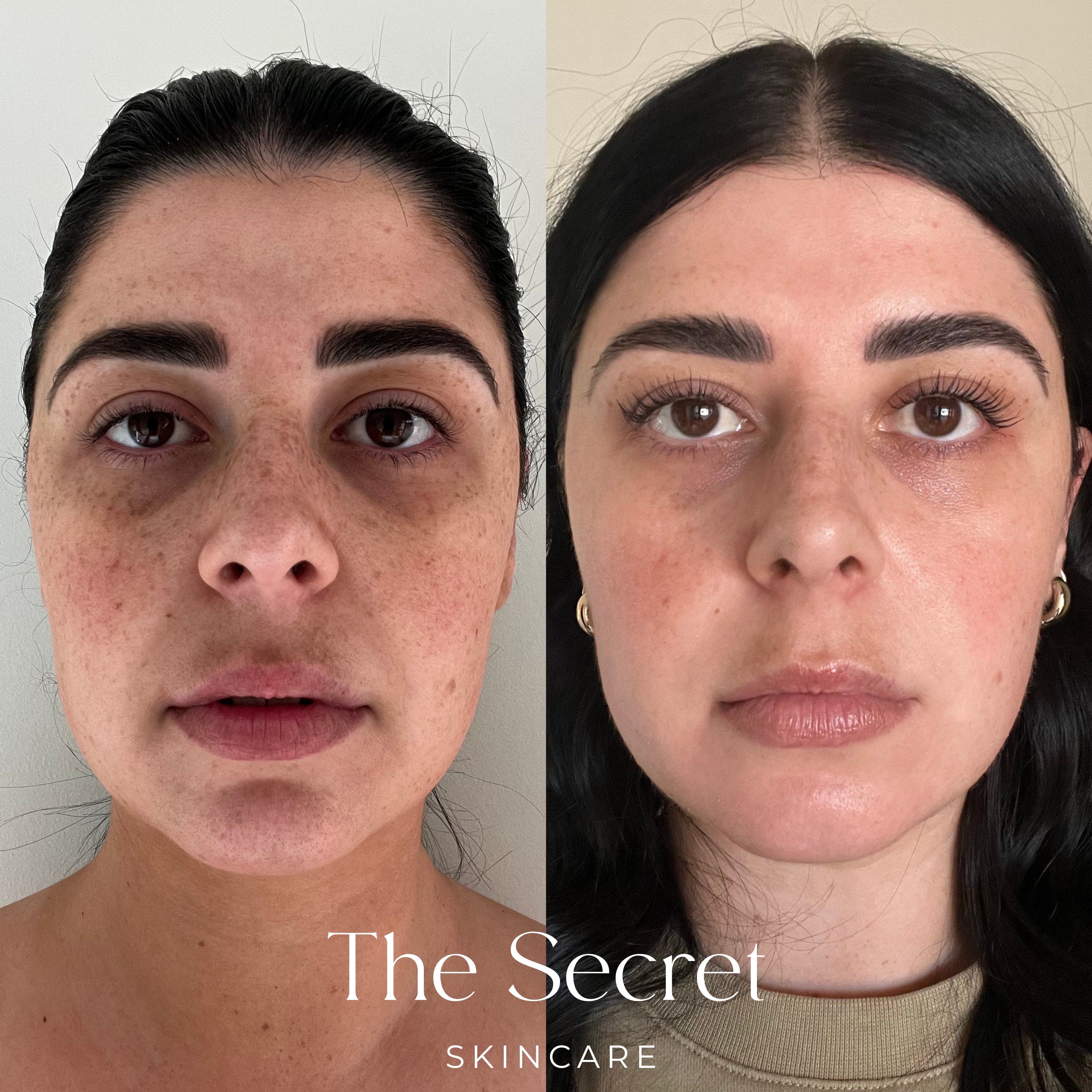 The Transformation Set
