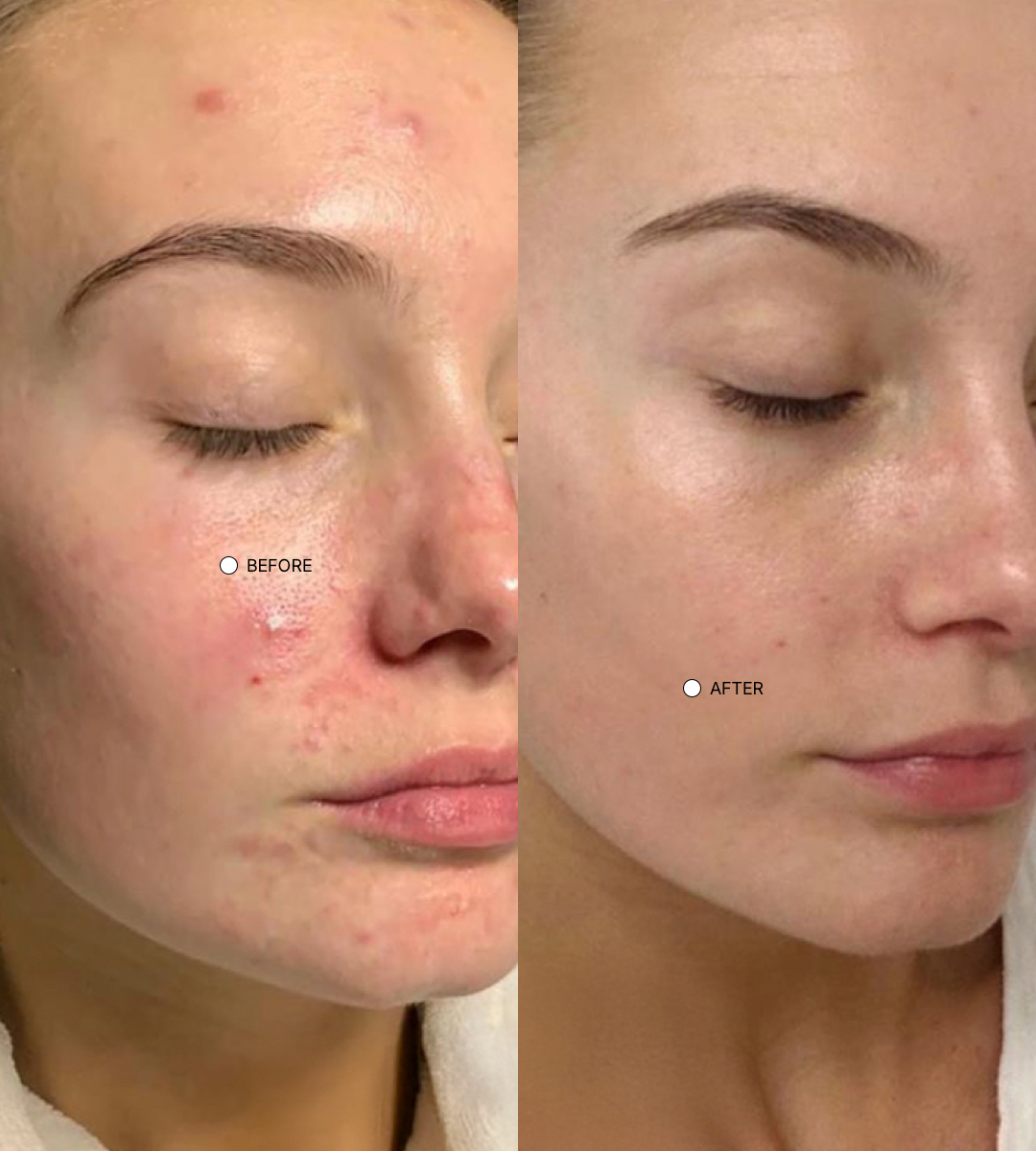 Spot Treatment