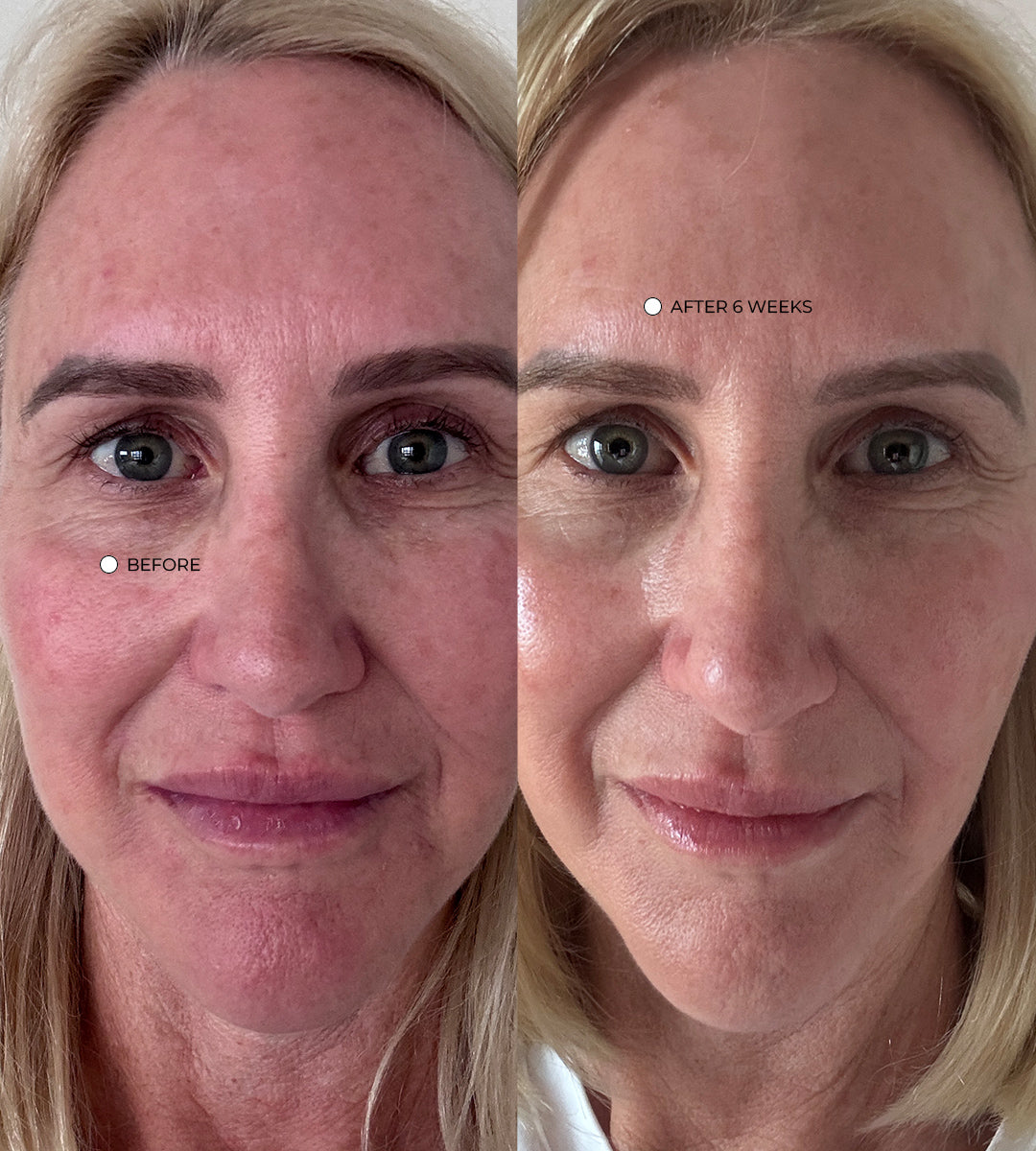 What the clinical trials show: skin thickness, wrinkle depth and collagen