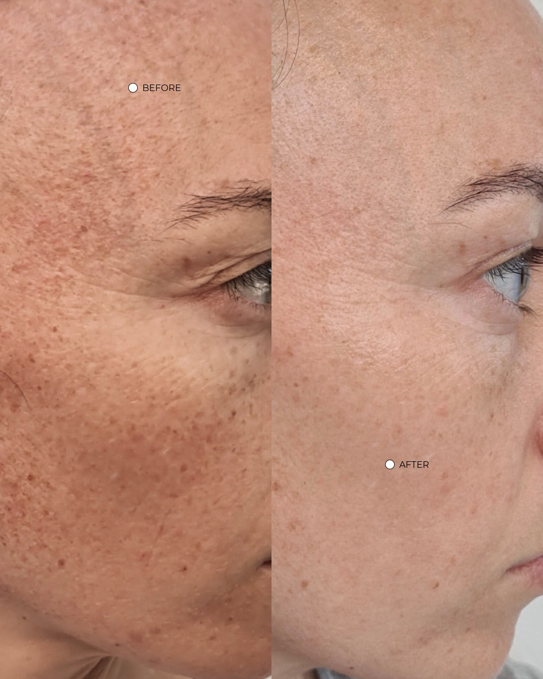 How to actually fade pigmentation, and why most products stall