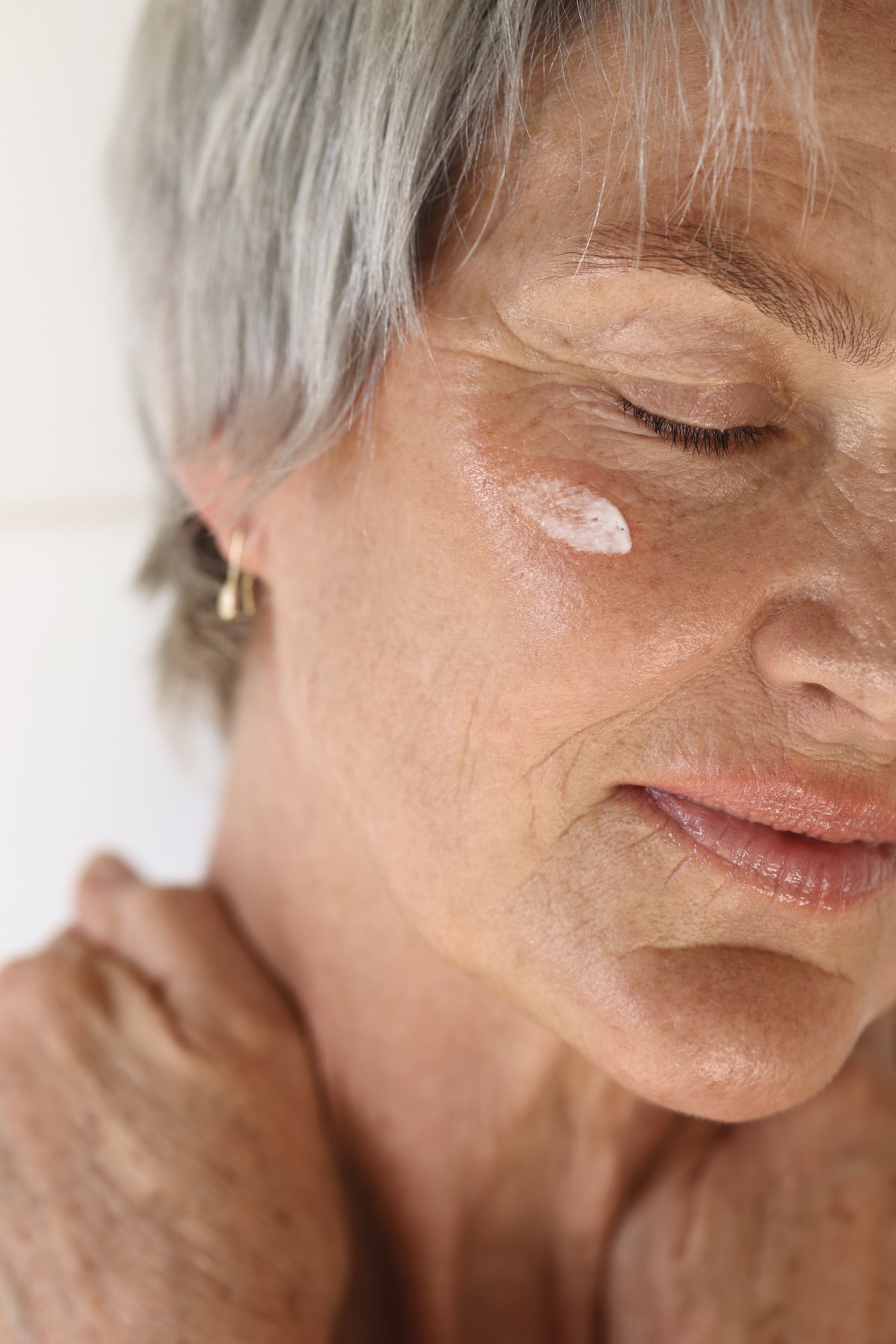 Image depicting a lady with clear skin after successful rosacea treatment | Best treatment for rosacea, how to treat rosacea, Rosacea triggers, Rosacea in men, What helps rosacea, Treating rosacea