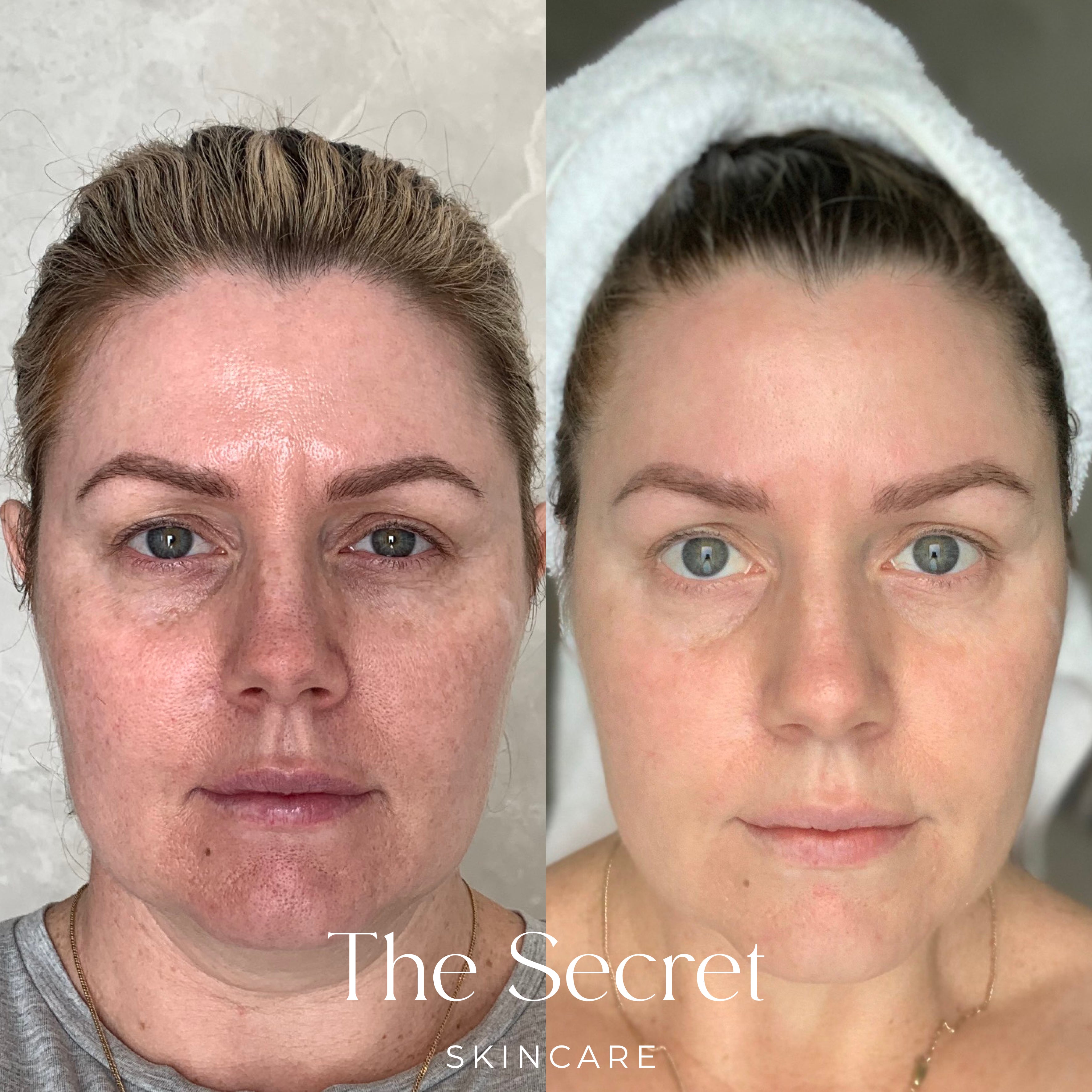 The Transformation Set
