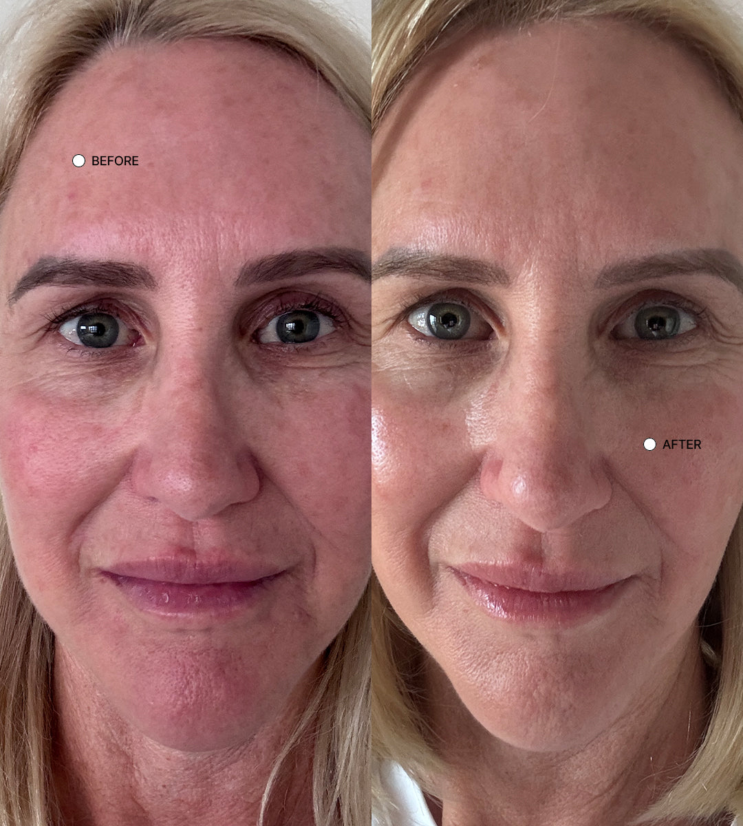 EstroRepair Cream