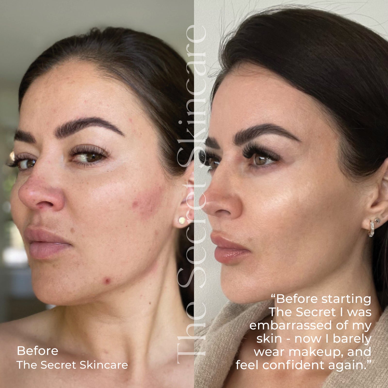 The Signature Set – The Secret Skincare